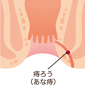 肛門科外来 胃腸科なら大阪市東淀川区上新庄の ゆうメディカルクリニック 公式